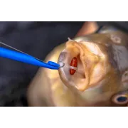 Degorjor Preston Bander Disgorger Twin Pack