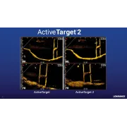 Sonar Lowrance HDS PRO 16 inch + sonda ActiveImaging HD 3-in-1